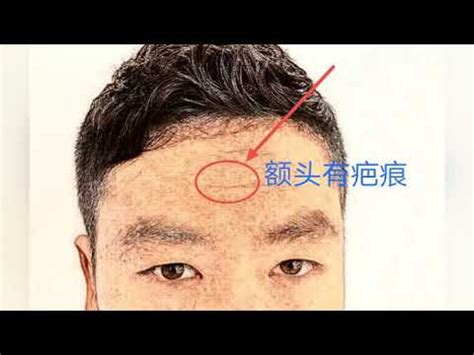 男人額頭有疤|【男人額頭有疤】男人額頭有疤？小心這幾大凶兆纏身！